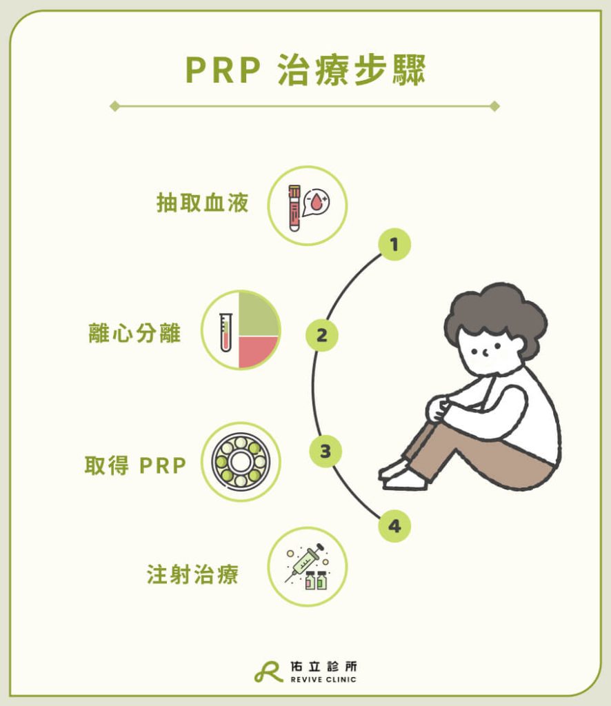 PRP 治療步驟